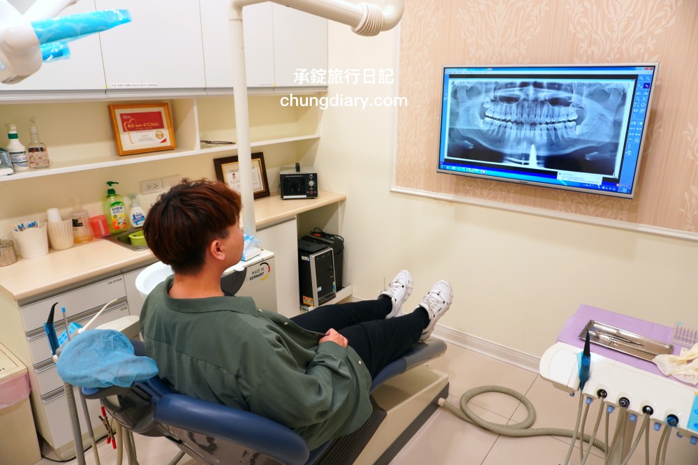 竹北牙醫診所【真美舒眠植牙中心】新竹專業醫師洗牙推薦！牙齒美白、單顆齒雕、微笑曲線設計、牙齦美容諮詢。