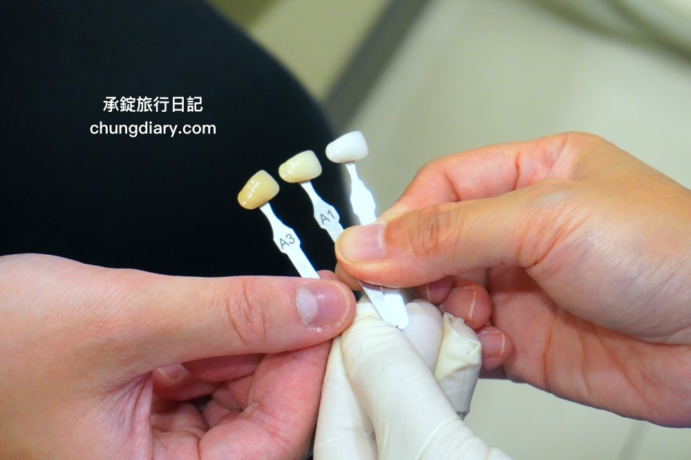 竹北牙醫診所【真美舒眠植牙中心】新竹專業醫師洗牙推薦！牙齒美白、單顆齒雕、微笑曲線設計、牙齦美容諮詢。