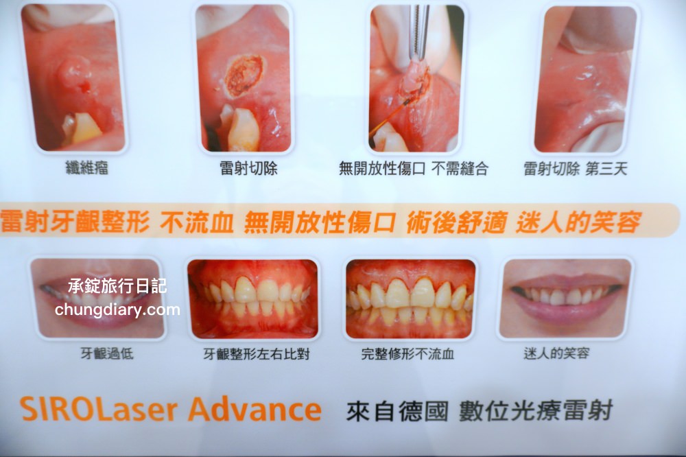 竹北牙醫診所【真美舒眠植牙中心】新竹專業醫師洗牙推薦！牙齒美白、單顆齒雕、微笑曲線設計、牙齦美容諮詢。