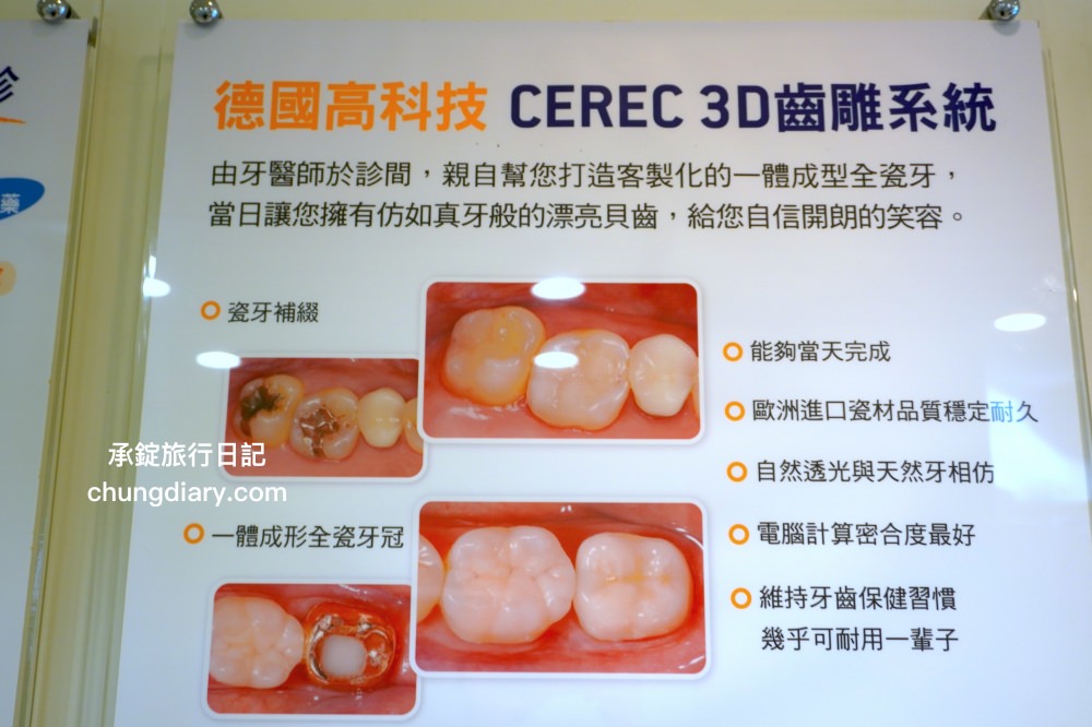 竹北牙醫診所【真美舒眠植牙中心】新竹專業醫師洗牙推薦！牙齒美白、單顆齒雕、微笑曲線設計、牙齦美容諮詢。