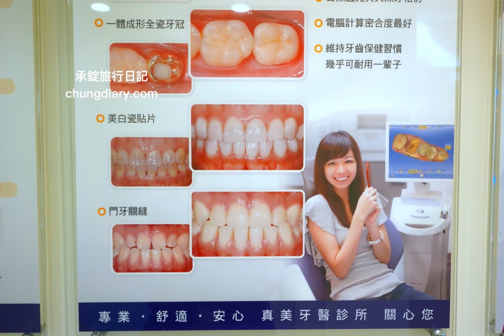 竹北牙醫診所【真美舒眠植牙中心】新竹專業醫師洗牙推薦！牙齒美白、單顆齒雕、微笑曲線設計、牙齦美容諮詢。