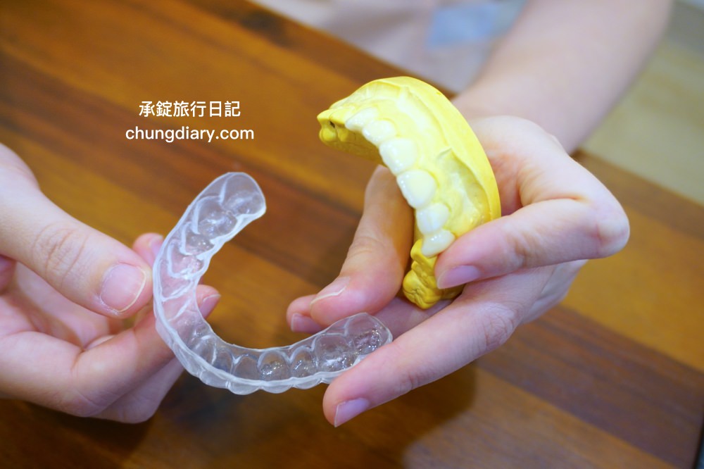 竹北牙醫診所【真美舒眠植牙中心】新竹專業醫師洗牙推薦！牙齒美白、單顆齒雕、微笑曲線設計、牙齦美容諮詢。