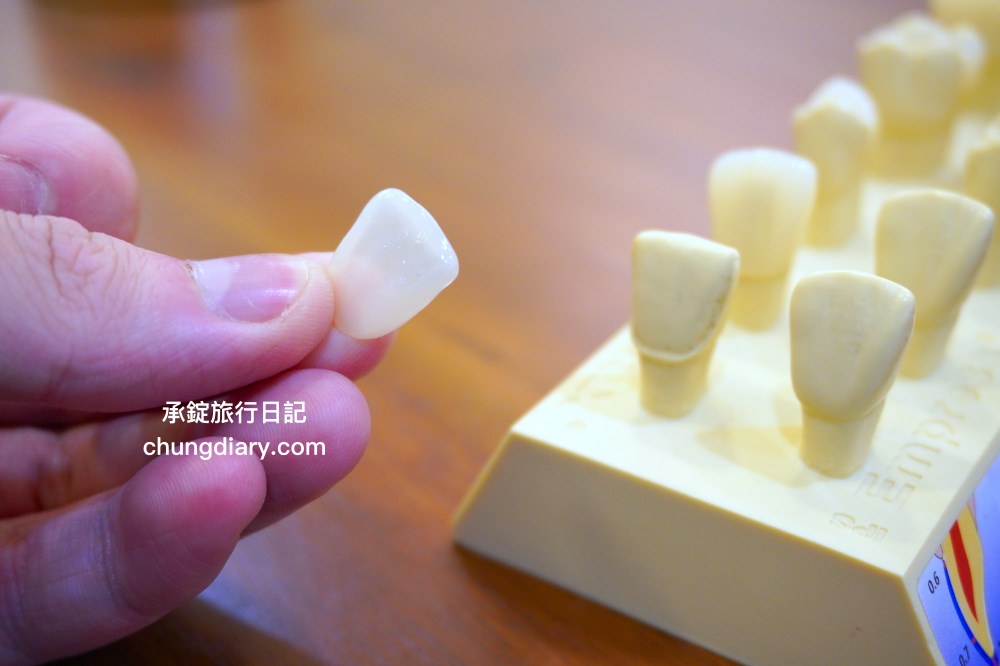 竹北牙醫診所【真美舒眠植牙中心】新竹專業醫師洗牙推薦！牙齒美白、單顆齒雕、微笑曲線設計、牙齦美容諮詢。