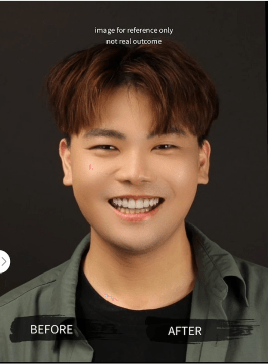 竹北牙醫診所【真美舒眠植牙中心】新竹專業醫師洗牙推薦！牙齒美白、單顆齒雕、微笑曲線設計、牙齦美容諮詢。