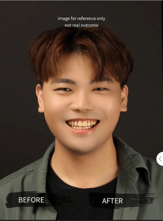 竹北牙醫診所【真美舒眠植牙中心】新竹專業醫師洗牙推薦！牙齒美白、單顆齒雕、微笑曲線設計、牙齦美容諮詢。